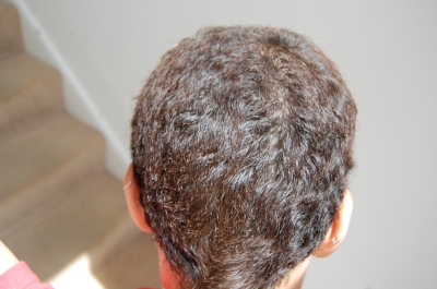 Wife    on Hair Growth After Chemo