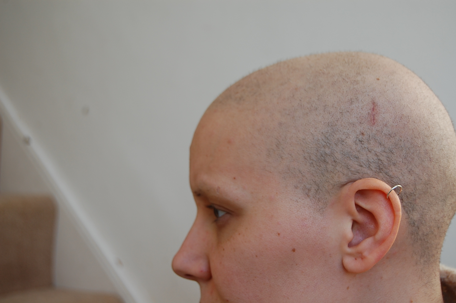 Week 8 Hair Growth After Chemo