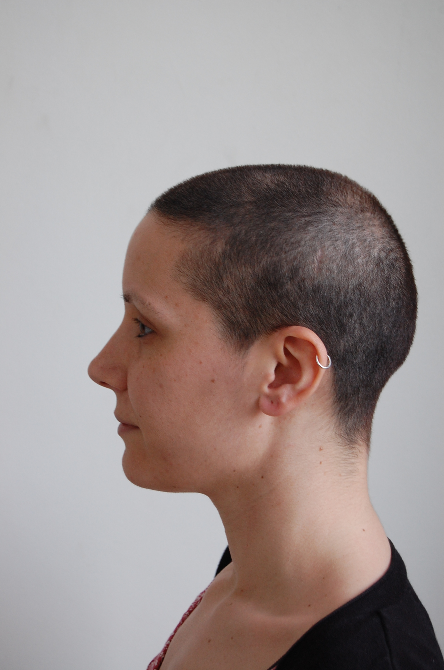 Week 16 Hair Growth After Chemo